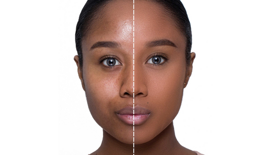 Avoid Having Flakey Skin When Applying Makeup