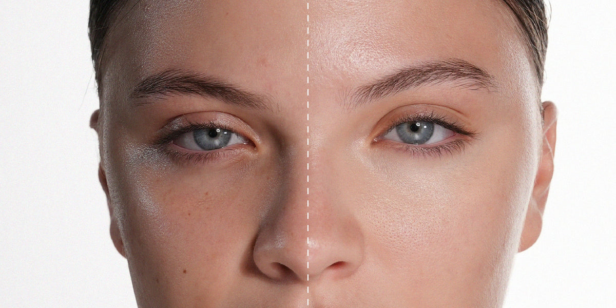 How to Cover Dark Under-Eyes with Makeup: A Step-by-Step Guide